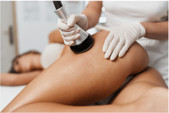 Liposukcja Kawitacyjna: Skuteczna Metoda Modelowania Sylwetki